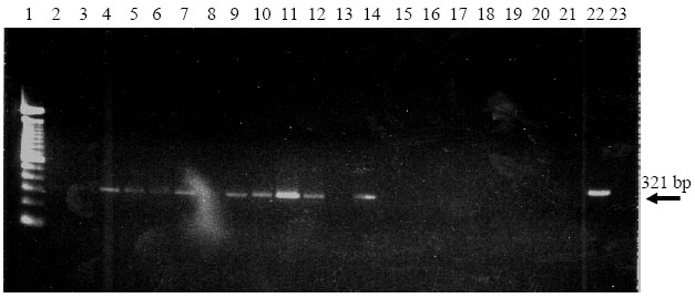 Image for - A Small-scale Procedure for Extracting Nucleic Acids from Grapevine Dormant Cuttings Infected with GFLV