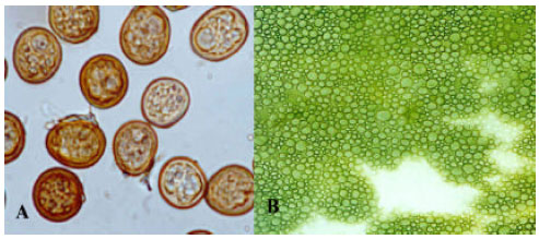 Image for - Investigation for Resistance Traits in three Hexaploid Amphiploids (Ttitipyrum,  Triticales and Wheats) to Seed Gall Nematode and Covered Smut Diseases