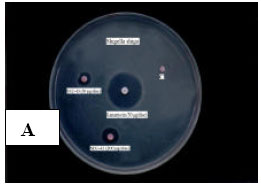 Image for - Biological Screening of Some Sewage Microbes in Bangladesh