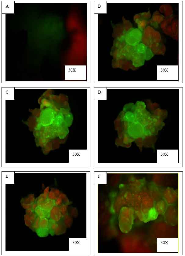Image for - Transient Expression of gusA and gfp Gene in Agrobacterium-mediated Banana Transformation Using Single Tiny Meristematic Bud