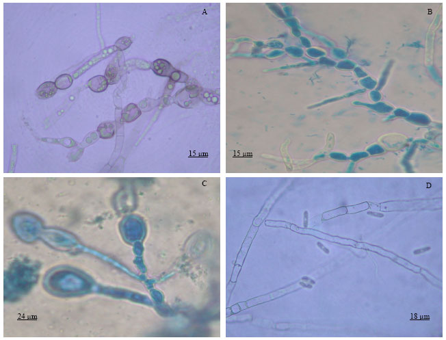 Image for - Screening of Antagonistic Bacteria for Biocontrol Activities on Colletotrichum gloeosporioides in Papaya 
