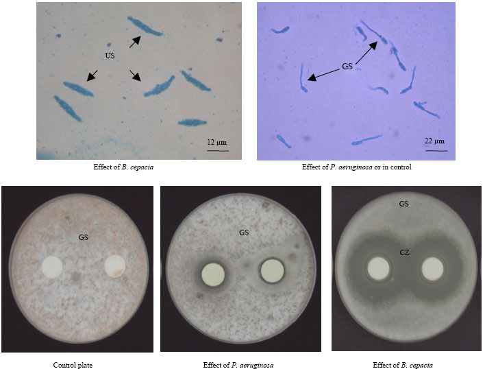 Image for - Screening of Antagonistic Bacteria for Biocontrol Activities on Colletotrichum gloeosporioides in Papaya 
