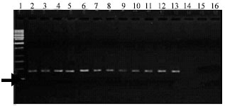Image for - Isolation and Identification of Yeast-Like and Mycelial Colonies of Ustilago scitaminea Using Specific Primers