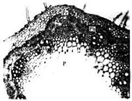 Image for - Anatomy of the Stem of Pigeonpea (Cajanus cajan)