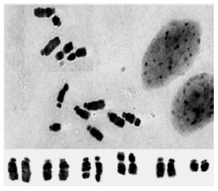 Image for - Karyotype of Several Vicia Species from Iran