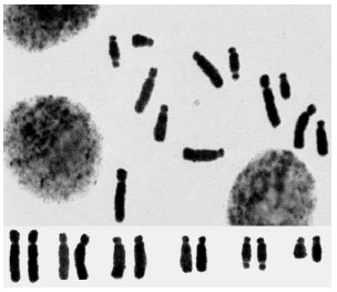 Image for - Karyotype of Several Vicia Species from Iran