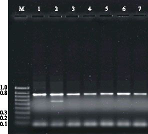 Image for - An Optimised Protocol for Fast Genomic DNA Isolation from High Secondary Metabolites and Gum Containing Plants