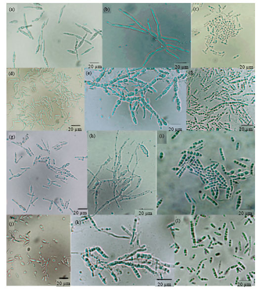 Image for - Four Novel Ustilaginomycetous Anamorphic Yeast Species Isolated as Endophytes from the Medicinal Plant Hyoscyamus muticus
