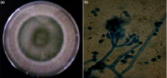 Image for - Assessment of Growth and Cellulase Production of Wild-Type Microfungi Isolated from Ota, Nigeria