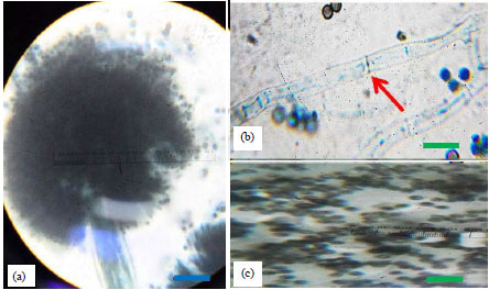 Image for - Molecular Identification of Rhizospheric Fungi Associated with‘Saba’ Banana via the Amplification of Internal TranscribedSpacer Sequence of 5.8S Ribosomal DNA