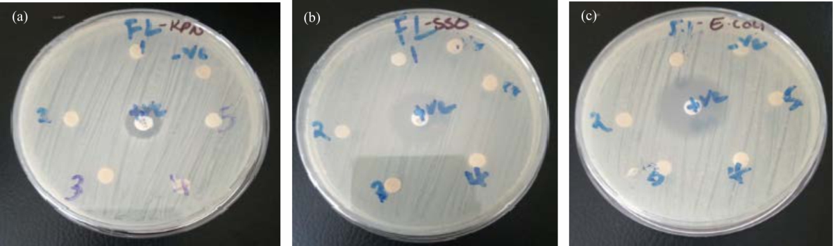 Image for - Antibacterial Activities Investigation of Leucas calostachys Root Extracts