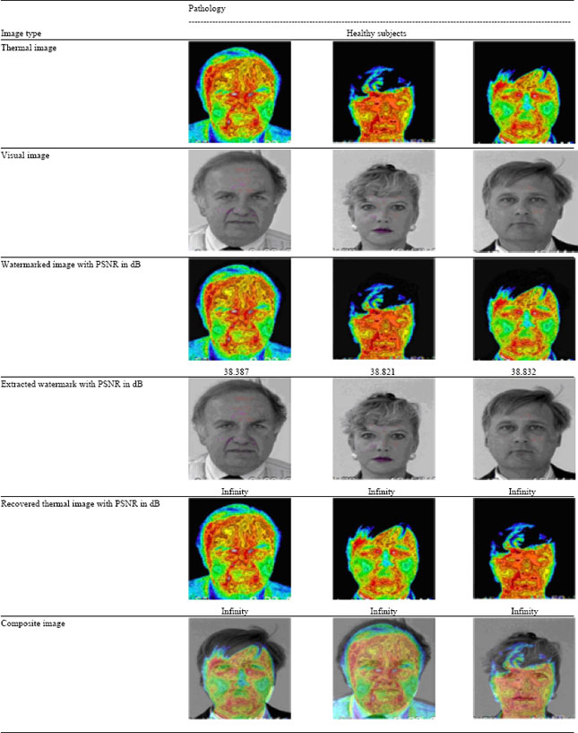 Image for - A Semiblind Reversible Watermarking Scheme for Authentication and Fusion of Facial Thermograms