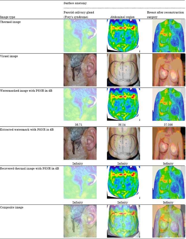 Image for - A Semiblind Reversible Watermarking Scheme for Authentication and Fusion of Facial Thermograms