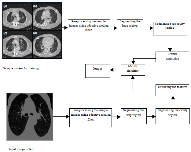 Image for - An Efficient ANFIS based Approach for Screening of Chronic Obstructive Pulmonary Disease (COPD) from Chest CT Scans with Adaptive Median Filtering