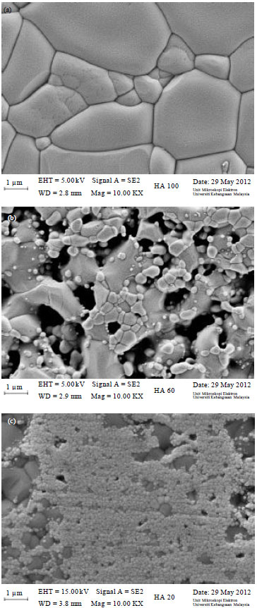 Image for - Synthesis and Characterization of Hydroxyapatite-Zirconia Composites for  Dental Applications