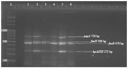 Image for - Antibiotics Susceptibility Pattern and Virulence-associated Genes in Clinical and Environment Strains of Pseudomonas aeruginosa in Iraq