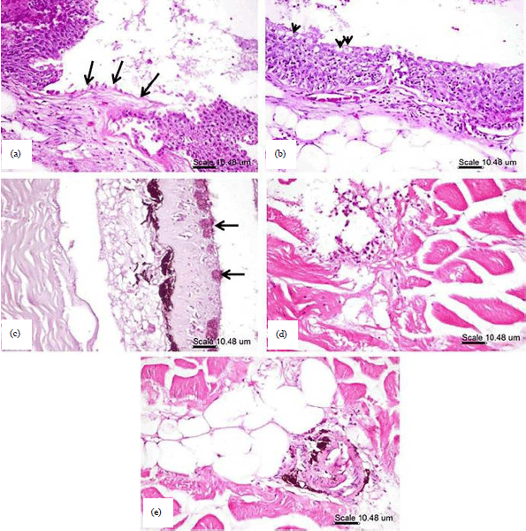 Image for - Nerocila bivittata Massive Infestations in Tilapia zillii with Emphasis on Hematological and Histopathological Changes