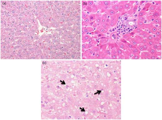 Image for - Alteration of Serum and Hepatic Trace Element Level in Non-alcoholic Fatty Liver Disease-induced by High-fat Sucrose Diet