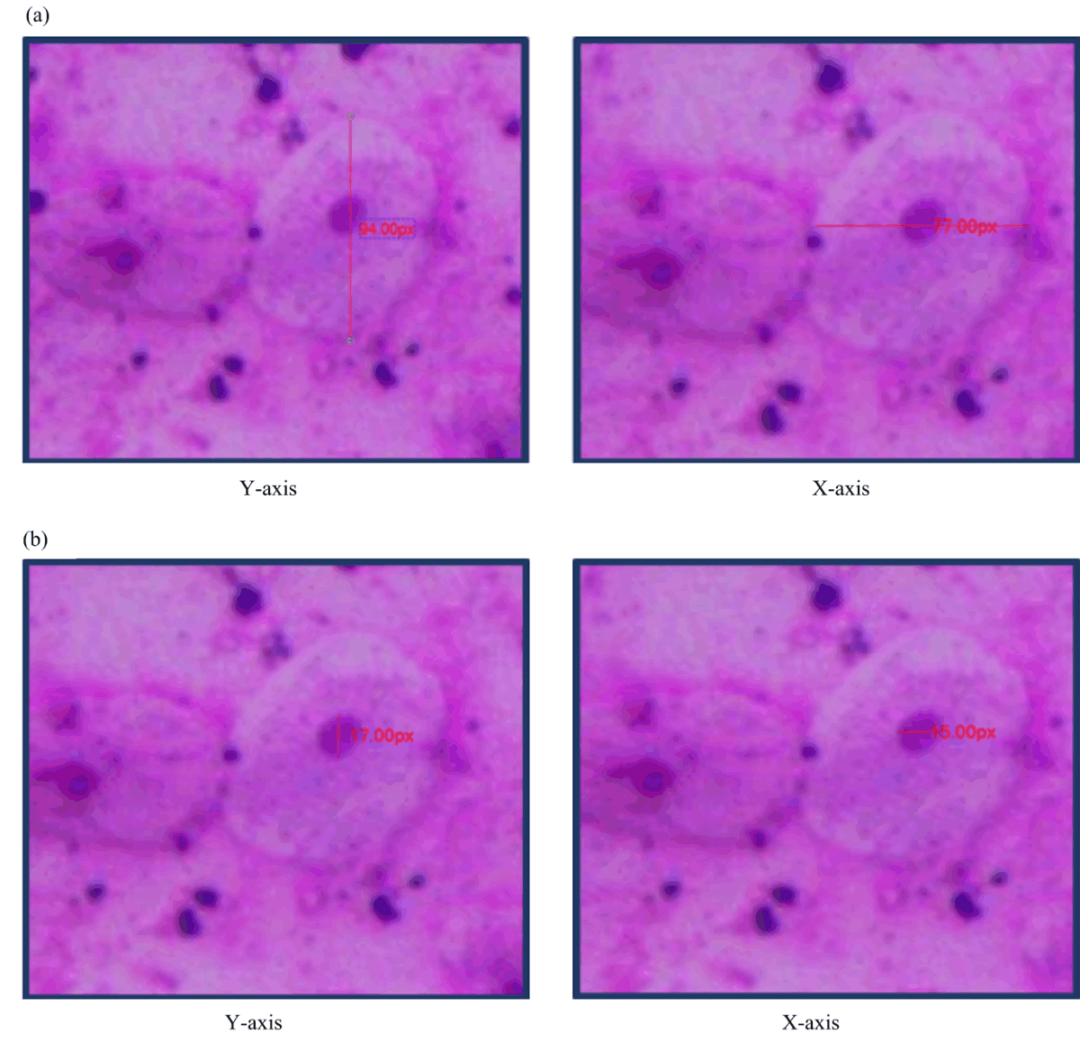Image for - Evaluation of Exfoliated Buccal Mucosal Cells from Snuff Dealers: A Quantitative Cytomorphometric Analysis