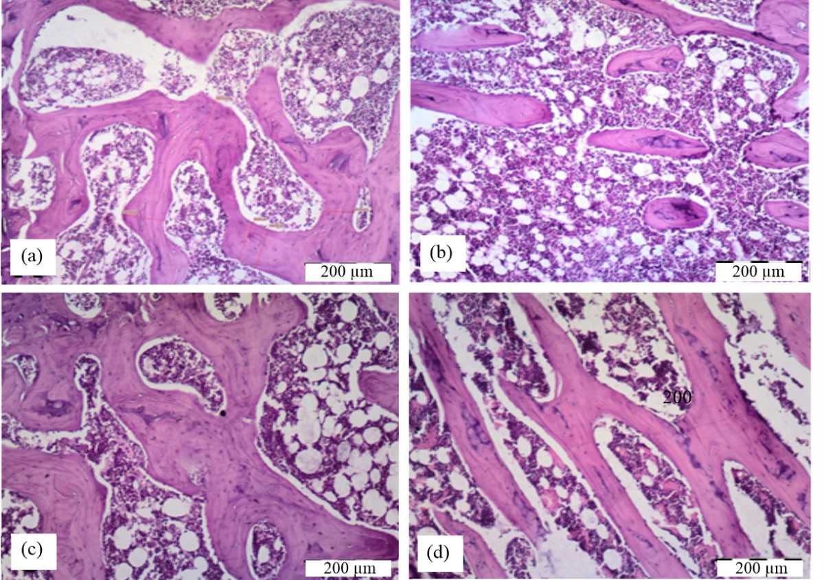 Image for - Potential Effects of Oligofructose-Enriched Inulin Macromolecules (PrebiotinTM) on an Ovariectomy-Induced Osteoporotic Rat Model