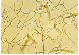 Image for - First Report of Antibacterial Properties of a New Strain of Streptomyces 
  plicatus (Strain 101) Against Erwinia carotovora subsp. Carotovora 
  from Iran