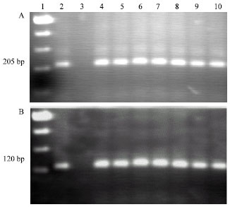 Image for - Reliable DNA Extraction on Historical Malaria Negative Smears Conducted to Nested PCR in South-East of Iran