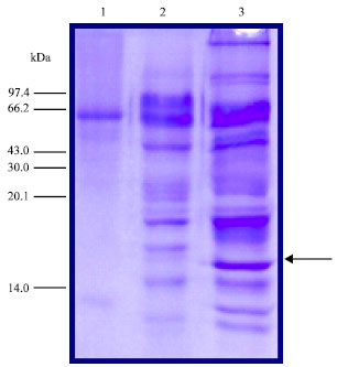 Image for - Molecular Cloning and Expression in Escherichia coli of Pseudomonas aeruginosa lipase gene