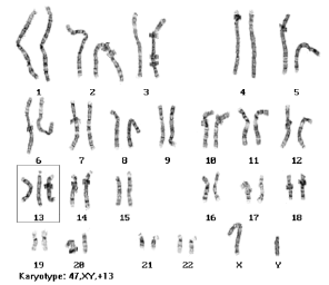 Image for - Detection of Specific Human Chromosomal Abnormalities Using Discrete Cosine Transform Based Gradient Vector Flow Active Contours