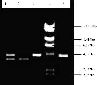 Image for - Plasmid Incidence in Four Species of Hydrocarbonoclastic Bacteria Isolated from Oil Polluted Marine Environment