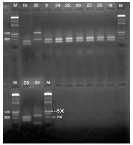 Image for - Rapid Molecular Diagnosis for Candida species Using PCR-RFLP