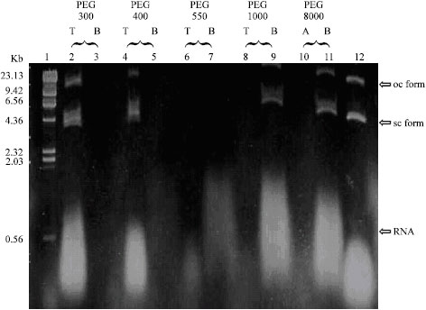 Image for - Extraction of Dengue 2 Plasmid DNA Vaccine (pD2) from Cell Lysates by Aqueous Two-Phase Systems