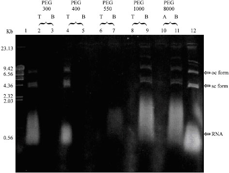Image for - Extraction of Dengue 2 Plasmid DNA Vaccine (pD2) from Cell Lysates by Aqueous Two-Phase Systems
