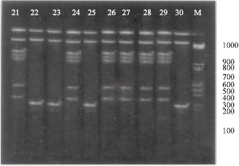 Image for - Random Amplification of Polymorphic DNA (RAPD) of Salmonella enteritidis Isolated from Chicken Samples