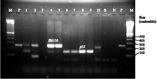 Image for - The Usefulness of PCR Amplification for Direct Detection of Mycobacterium tuberculosis DNA from Clinical Samples
