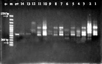Image for - Molecular Typing of Iranian Cladosporium Isolates Using RAPD-PCR