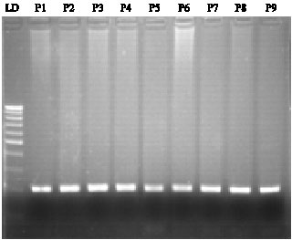 Image for - Genetic Polymorphism of 5, 10-Methylenetetrahydrofolate Reductase C677T in Kashmiri Population