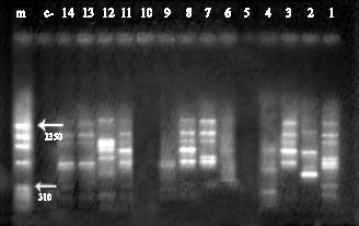 Image for - Molecular Typing of Iranian Cladosporium Isolates Using RAPD-PCR