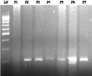 Image for - Genetic Polymorphism of 5, 10-Methylenetetrahydrofolate Reductase C677T in Kashmiri Population