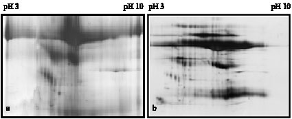 Image for - Protein Precipitation Method for Salivary Proteins and Rehydration  Buffer for Two-Dimensional Electrophoresis