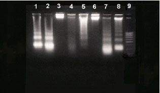 Image for - Detection of DNA Damage, Molecular Apoptosis and Production of Home-Made Ladder by Using Simple Techniques