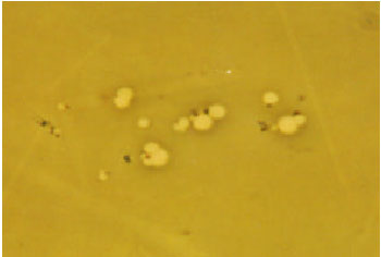 Image for - Isolation of Vacuoles from Fragile Spheroplasts of Candida tropicalis with Lyticase