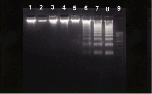 Image for - Detection of DNA Damage, Molecular Apoptosis and Production of Home-Made Ladder by Using Simple Techniques