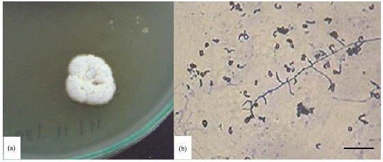 Image for - Antagonistic Effects of Streptomyces sp. SRM1 on Colletotrichum musae