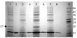 Image for - Screening of Variables Influencing the Production of HPV E7 Oncoproteins by Recombinant Escherichia coli