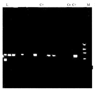 Image for - Evaluation of Gene Targeted PCR and Molecular Hybridization Used in Diagnosis of Human Leishmania Isolates
