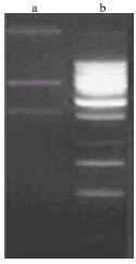 Image for - Identification, Cloning and Sequence Analysis of Chitinase Gene in Bacillus halodurans Isolated from Salted Fish