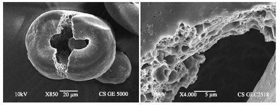 Image for - Chitosan Microparticles Prepared by the Water-in-Oil Emulsion Solvent Diffusion Method for Drug Delivery