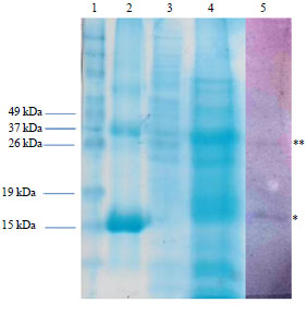 Image for - Construction, Expression and Characterization of Multi Cassettes Encoding Indonesian Small Hepatitis B Surface Antigen (s-HBsAg) in Methylotropic Yeast Pichia pastoris