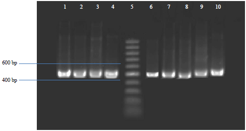 Image for - 18s rDNA Sequence Analysis of Microfungi from Biofloc-based System in Pacific Whiteleg Shrimp, Litopenaeus vannamei Culture