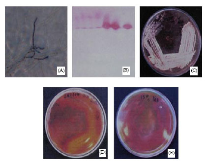 Image for - Novel Approaches for Identification of Streptomyces noboritoensis TBG-V20 with Cellulase Production
